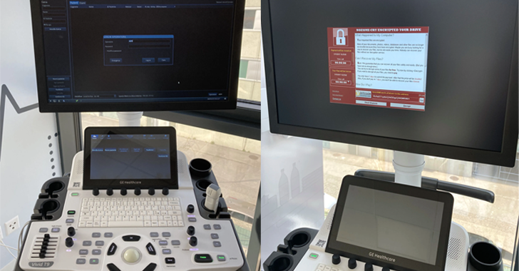 Você está visualizando atualmente Pesquisadores Descobrem 11 Falhas de Segurança em Máquinas de Ultrassom GE HealthCare